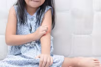 Những bệnh ngoài da thường gặp ở trẻ