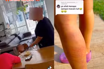 Một đôi vợ chồng bị bắt khi video bạo hành con nuôi xuất hiện ở TikTok