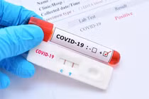 5 dấu hiệu báo động đỏ khi phục hồi sau Covid-19