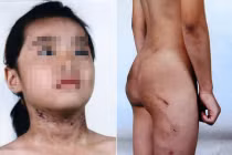 Bé 6 tuổi bị mẹ kế bạo hành như thời trung cổ