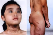 Bé 6 tuổi bị bạo hành: Lật mặt giả dối của mẹ kế?