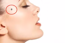 5 vị trí nốt ruồi xui xẻo, hủy hoại vận mệnh của một người