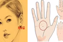 Những nốt ruồi mang phúc khí, tài lộc kéo đến không ngừng