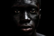 Tại sao đàn ông da đen mắc ung thư tuyến tiền liệt cao hơn?