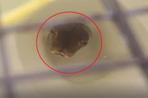 Nghe tiếng ọc ọc từ bồn cầu, sốc nặng thấy 'quái thú' bên trong 