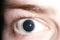 Loại ma túy "cực độc" gây tâm thần phân liệt suốt đời