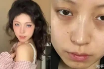 Nhan sắc giảm 10, cô gái trẻ đòi công ty bồi thường 30 triệu