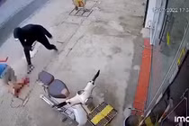 Hà Nội: Đang đi trên đường, người đàn ông bị chém đứt lìa chân