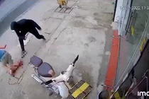 Hà Nội: Đang đi trên đường, người đàn ông bị chém đứt lìa chân