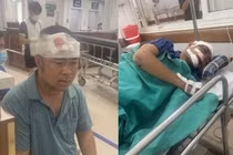 Truy bắt nhóm đối tượng đánh trọng thương 5 công nhân ở Lào Cai