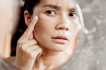 4 thói quen làm tăng nguy cơ mắc ung thư