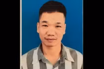Truy tìm phạm nhân thụ án 30 năm tù bỏ trốn khi đang mổ chân