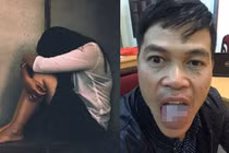 Động cơ đê hèn của kẻ hiếp dâm nữ sinh rồi bị cắn đứt lưỡi