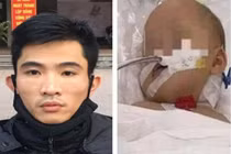 Lời khai của đối tượng đóng đinh vào đầu bé gái 3 tuổi ở Hà Nội