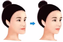 Bật mí số vận tướng người mặt gãy: Có chán như lời đồn?