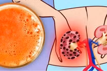 7 loại thực phẩm thường ăn có thể hủy hoại thận của bạn