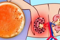 7 loại thực phẩm thường ăn có thể hủy hoại thận của bạn