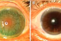 Vì sao rắn hổ mang phun nọc độc "bách phát bách trúng" vào mắt người?