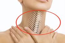 Xương cá mắc nghẹn cổ họng, nuốt cơm dấm là sai! 