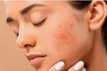 Các yếu tố âm thầm gây ung thư da