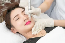 Chăm sóc sau khi phun môi thế nào để đôi môi tươi tắn rạng rỡ?