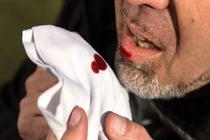 Chế độ ăn uống cho người bị xuất huyết dạ dày