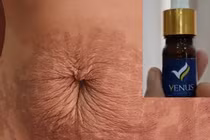 Thẩm mỹ viện quốc tế Venus bị phạt 85 triệu, đóng cửa 9 tháng