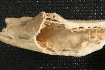 Khám phá bí mật bộ xương ung thư 3.000 năm tuổi