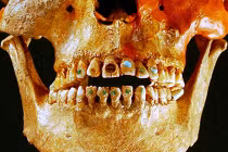 Top sự thật không tưởng về hàm răng