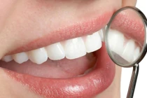 Những con số biết nói về căn bệnh ung thư miệng