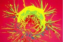 Những tưởng tượng phi lý về căn bệnh ung thư