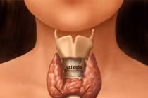 Dấu hiệu chứng tỏ bạn bị ung thư tuyến giáp