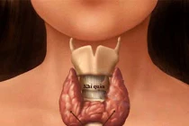 Dấu hiệu chứng tỏ bạn bị ung thư tuyến giáp