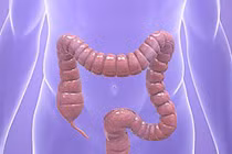 Những hiểu lầm thường gặp về ung thư đại tràng