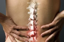 Dấu hiệu giúp nhận diện ung thư xương