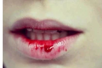 HPV tàn phá răng miệng khủng khiếp hơn cả thuốc lá