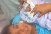 Mắc u nang buồng trứng vẫn nhất quyết sinh con