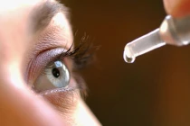 Nguyên nhân phổ biến gây dị ứng mắt