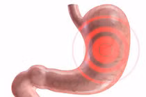 13 dấu hiệu bạn bị viêm dạ dày 