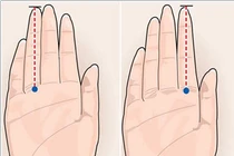 Tiết lộ sửng sốt về chiều dài ngón tay và ung thư