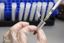 Các phương pháp chẩn đoán ung thư tinh hoàn