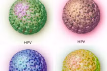 Những hiểu lầm thường gặp về ung thư cổ tử cung