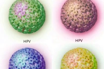 Những hiểu lầm thường gặp về ung thư cổ tử cung