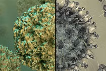 Dấu hiệu phân biệt cúm và cảm lạnh thông thường