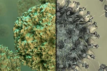 Dấu hiệu phân biệt cúm và cảm lạnh thông thường