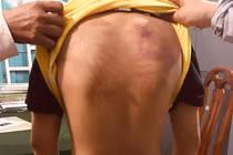 Bé trai 11 tuổi bị một người tu hành đánh dã man. Ảnh: Báo Pháp Luật TP HCM