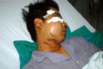 141 bị “tố” đánh dân: Công an vào cuộc điều tra