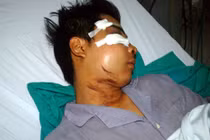 141 bị “tố” đánh dân: Công an vào cuộc điều tra