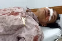 Côn đồ vào nhà đánh người trước mặt công an?