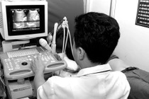 Buồng trứng đa nang khó có con?